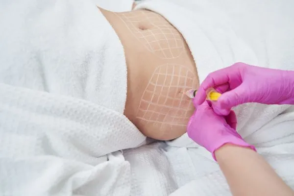 image of fat dissolving injections on love handles to help combat weight gain Wilmslow