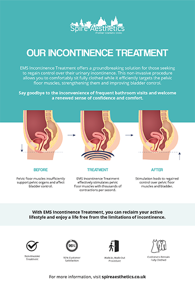 image of how urge incontinence Wilmslow treatment works