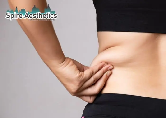 Image of woman pinching fat on their hips Wilmslow. Fat Freezing treatment