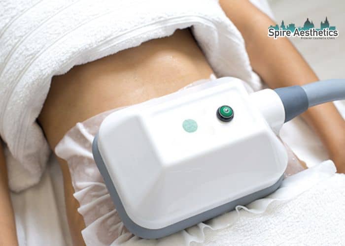 Shift Those Extra Pounds: How Fat Freezing Can Help You Slim Down Wilmslow