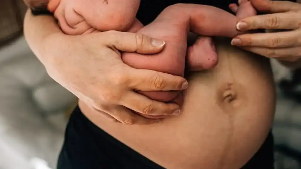 Why Is My Stomach Still Big After Pregnancy Wilmslow?